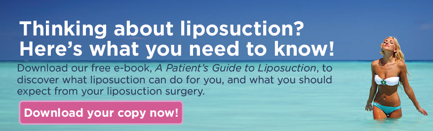 Liposuction consultation